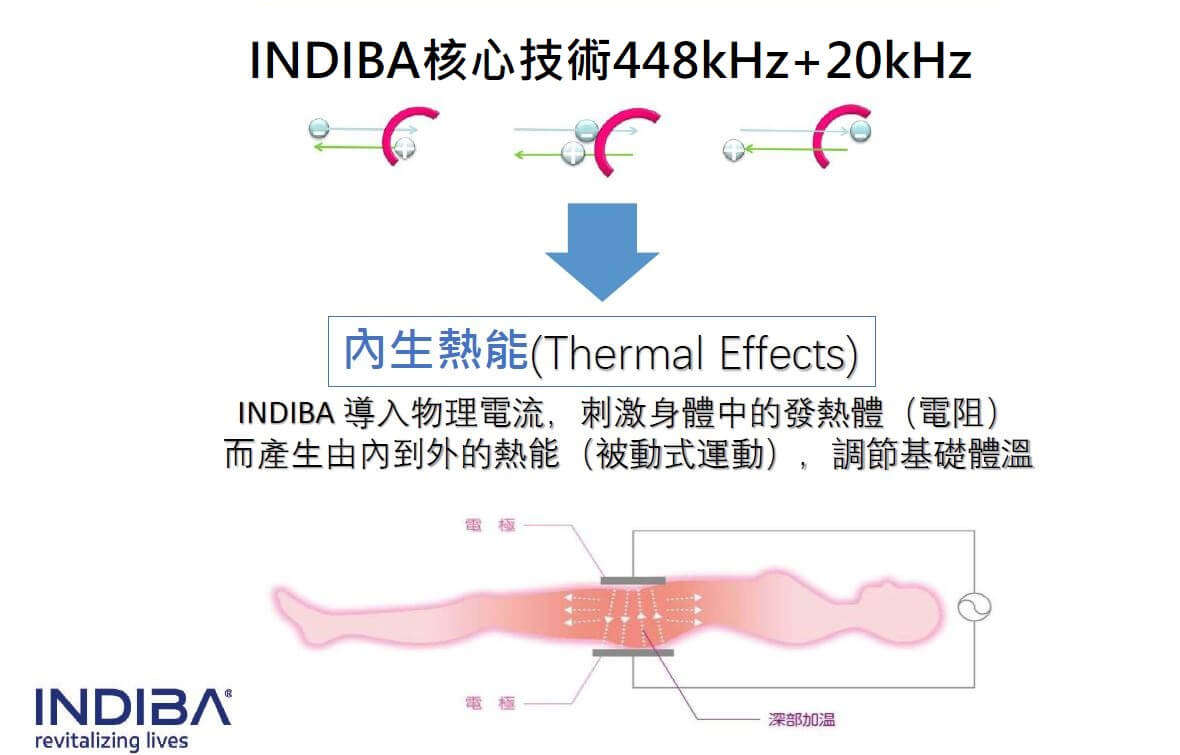 內生熱能-台中INDIBA英特波推薦