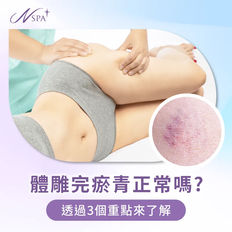 體雕完瘀青是正常的嗎?讓N SPA告訴你 體雕完瘀青-體雕瘀青