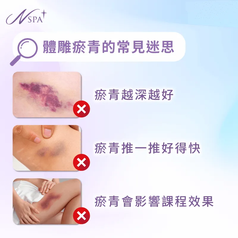 體雕瘀青的常見迷思有哪些?快來一次了解 常見迷思-體雕完瘀青