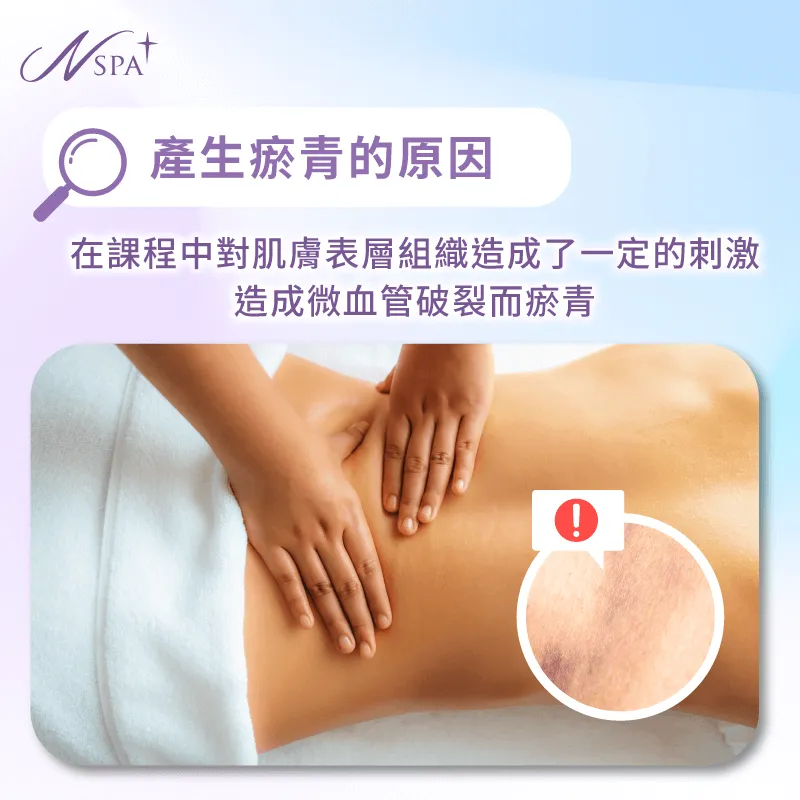 體雕完瘀青的原因是什麼?透過段落來了解 瘀青的原因-體雕完瘀青