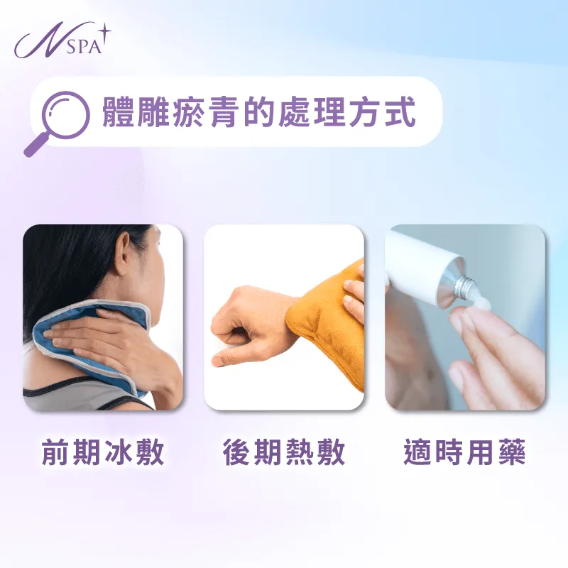 體雕後的瘀青應該怎麼處理?冰敷、熱敷、塗抹藥膏都是不錯的方式 處理方式-體雕完瘀青
