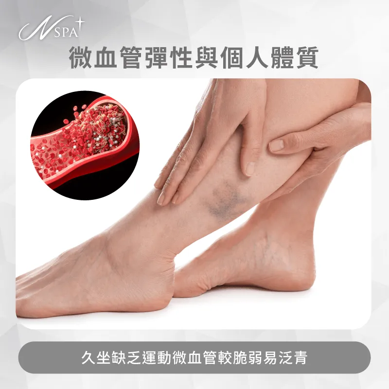 久坐族群微血管彈性評估-體雕瘀青原因