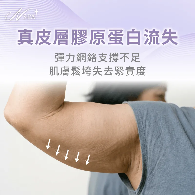 膠原流失導致手臂皮膚鬆弛-蝴蝶袖鬆弛怎麼辦