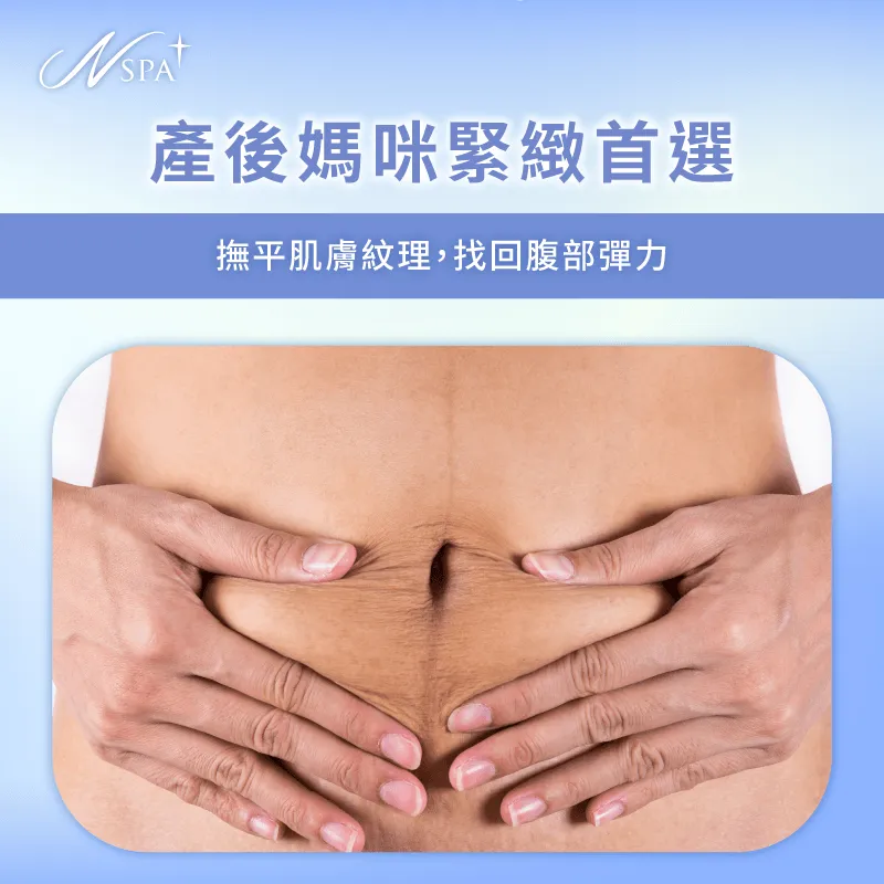產後肚皮緊緻保養首選-INDIBA適合對象